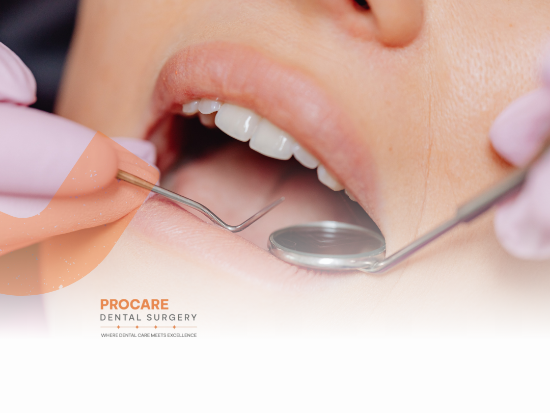 An illustrated guide comparing healthy and impacted wisdom teeth positioning in a jaw.