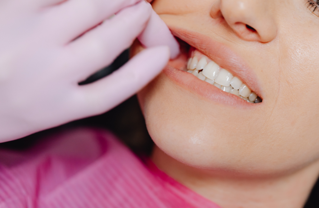 A gloved dentist inspecting a patient’s upper gums for early signs of gum disease during a clinical examination in Pretoria.